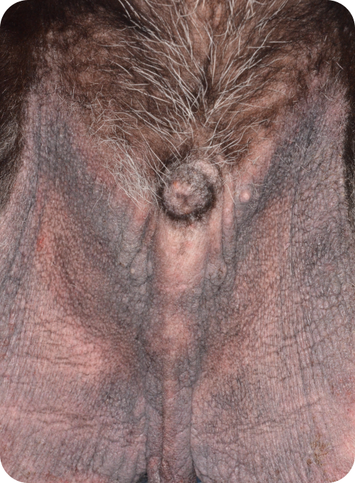 お腹に赤みが見られる犬の症例写真